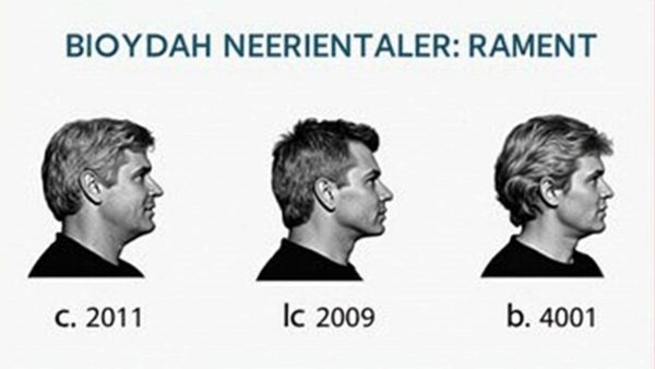 Diese 3 ADHS-Gehirne verraten mehr, als du je dachtest